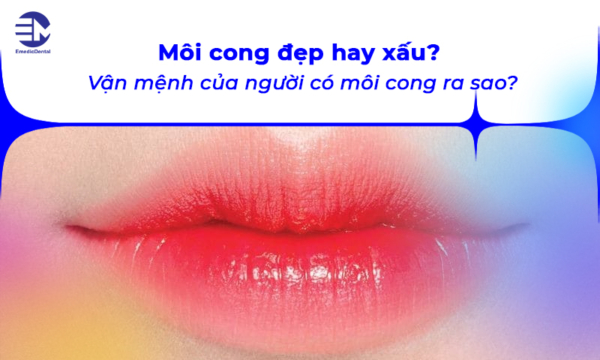 Môi cong đẹp hay xấu? Vận mệnh của người có môi cong ra sao?