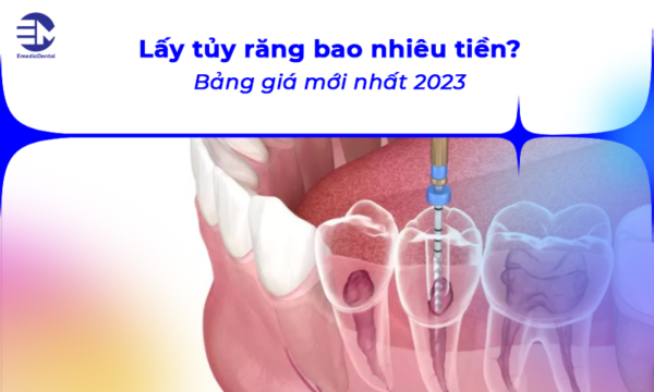 Lấy tủy răng bao nhiêu tiền? Bảng giá mới nhất 2023