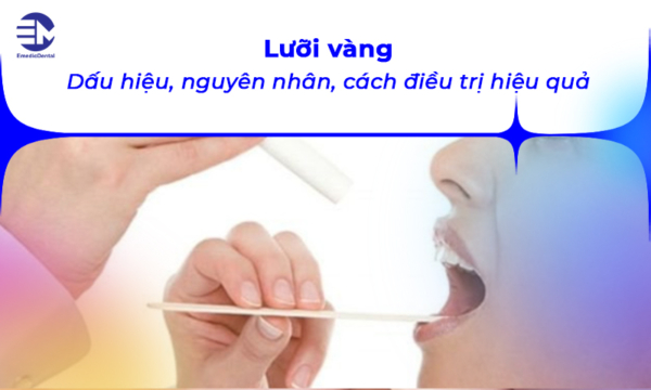 Lưỡi vàng: Dấu hiệu, nguyên nhân, cách điều trị hiệu quả