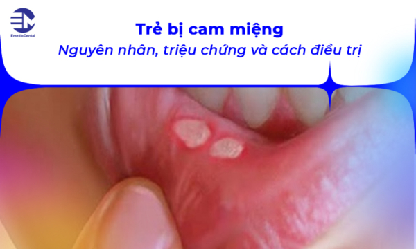 Trẻ bị cam miệng: Nguyên nhân, triệu chứng và cách điều trị