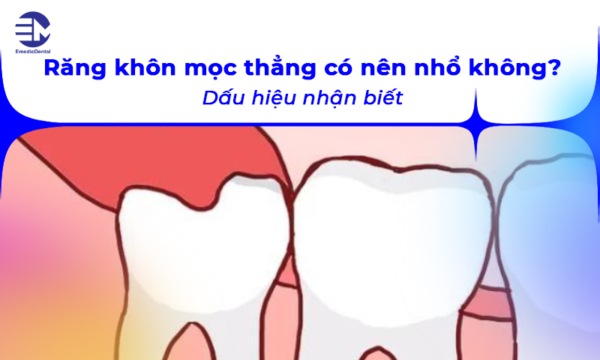 Răng khôn mọc thẳng có nên nhổ không? Dấu hiệu nhận biết