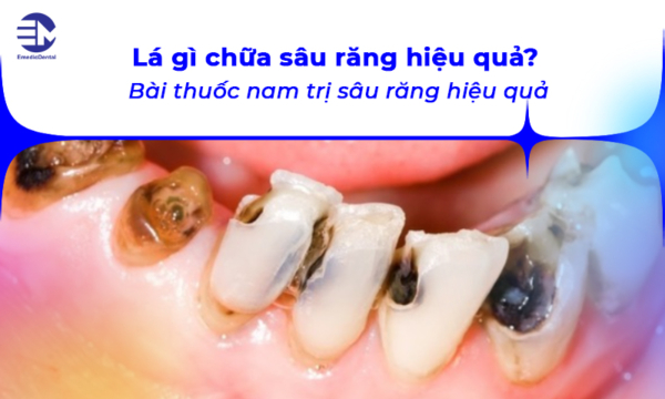 Lá gì chữa sâu răng hiệu quả? Bài thuốc nam trị sâu răng hiệu quả