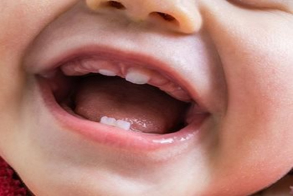 Lợi em bé sưng đỏ tấy, dấu hiệu cho thấy răng sắp mọc.