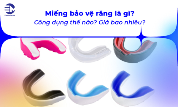 Miếng bảo vệ răng là gì? Công dụng thế nào? Giá bao nhiêu?