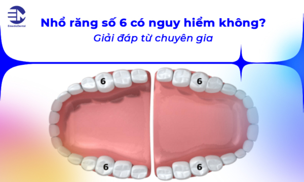 Nhổ răng số 6 có nguy hiểm không? Giải đáp từ chuyên gia