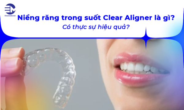 Niềng răng trong suốt Clear Aligner là gì? Có thực sự hiệu quả?