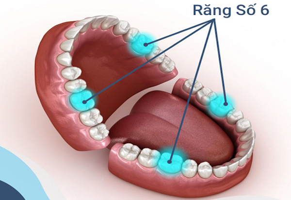 Răng số 6