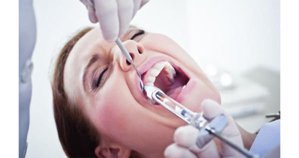 Quy trình tháo răng sứ cần thực hiện theo một quy trình khoa học, cẩn trọng