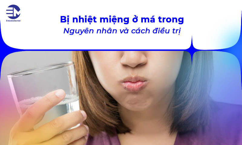 bị nhiệt miệng ở má trong