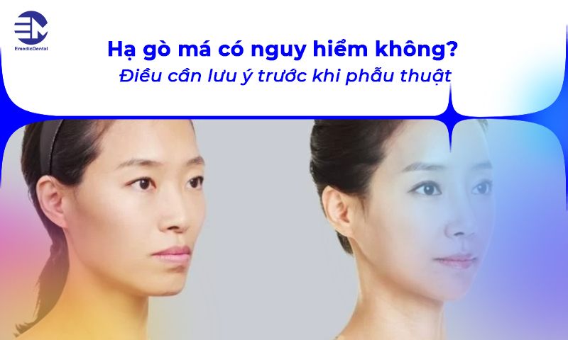 hạ gò má có nguy hiểm không