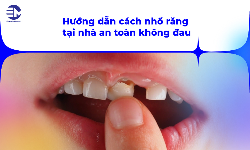 cách nhổ răng tại nhà