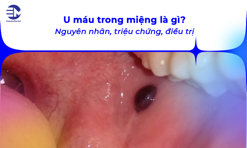 u máu trong miệng