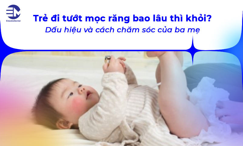 đi tướt mọc răng