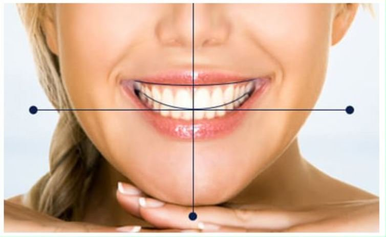 Khớp cắn chính xác là cực kỳ quan trọng để kết thúc thành công quá trình điều trị niềng răng