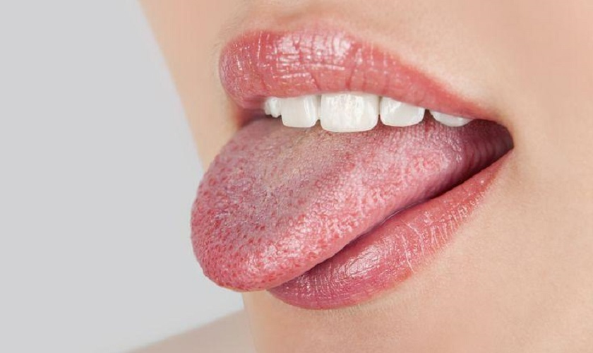 Lưỡi đốm đỏ có thể gây nguy hiểm nếu đi kèm các triệu chứng khó chịu
