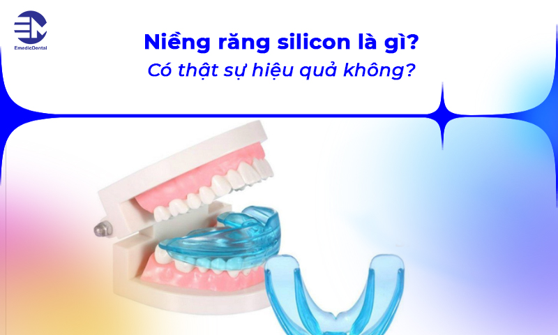 niềng răng silicon