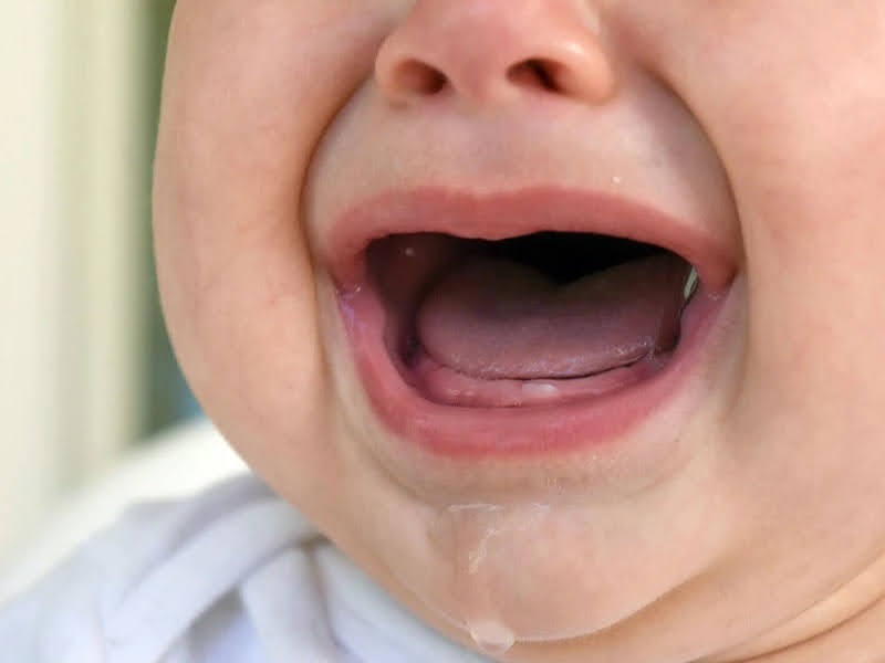 Trẻ chảy nhiều nước dãi là biểu hiện sốt mọc răng ở trẻ