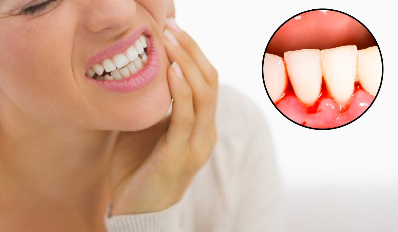 Việc điều trị triệt để căn nguyên là vô cùng quan trọng trong việc chữa ngứa chân răng