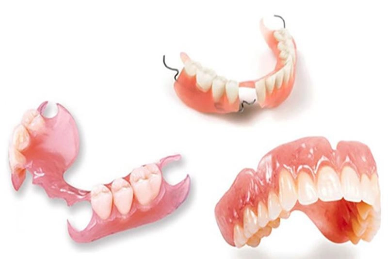 Có hai loại răng giả silicon phổ biến hiện nay