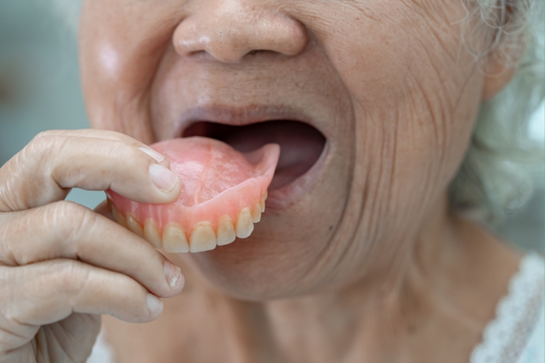 Răng giả silicon rất phù hợp với nhiều đối tượng trong đó có người già bị răng lung lay, rụng nhiều răng