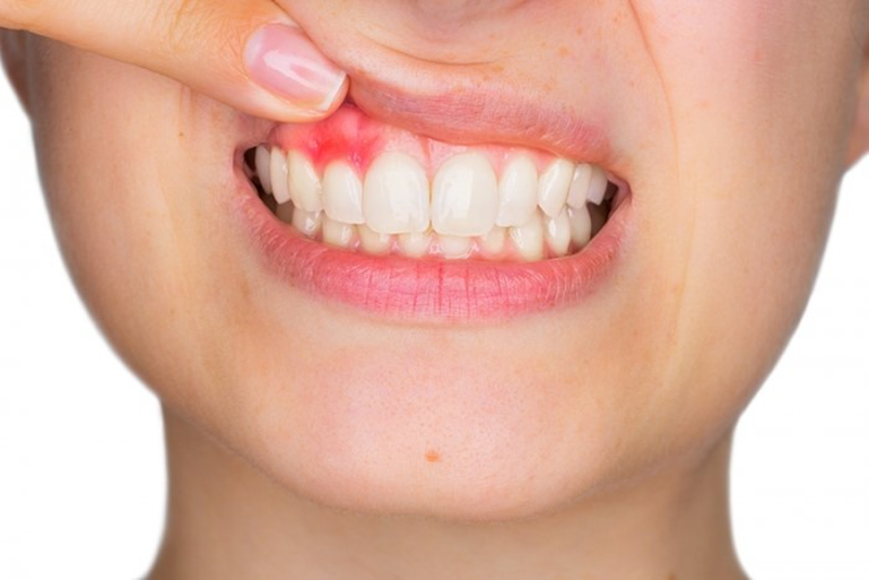Các triệu chứng thường gặp ở người bị ngứa chân răng