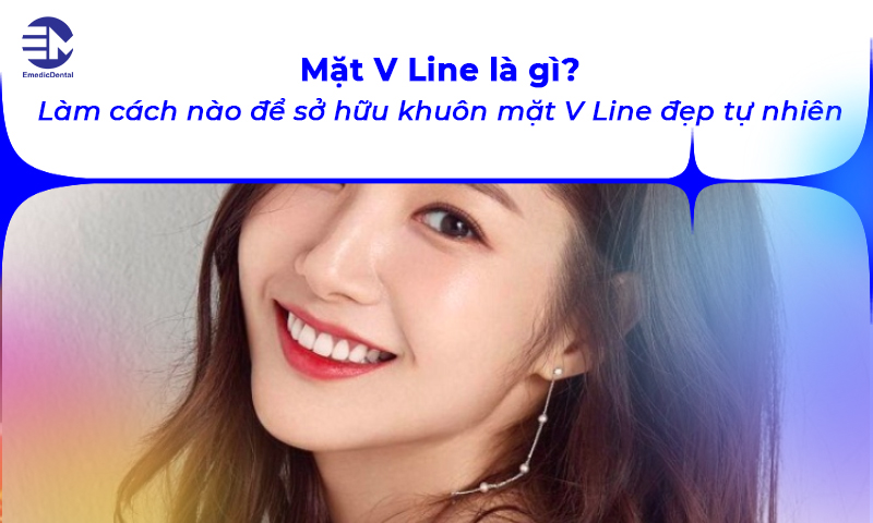 Mặt V Line