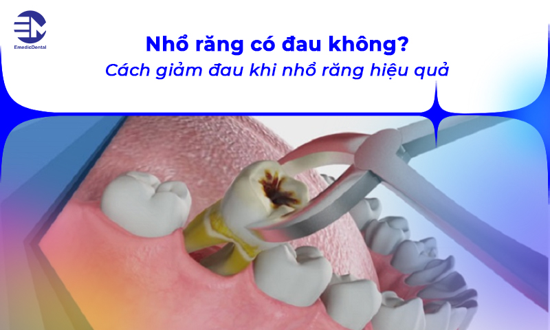 nhổ răng có đau không