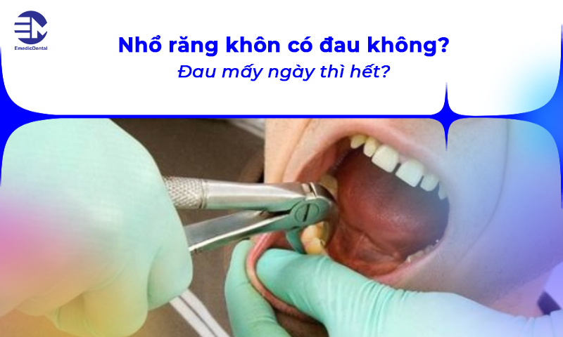 nhổ răng khôn có đau không