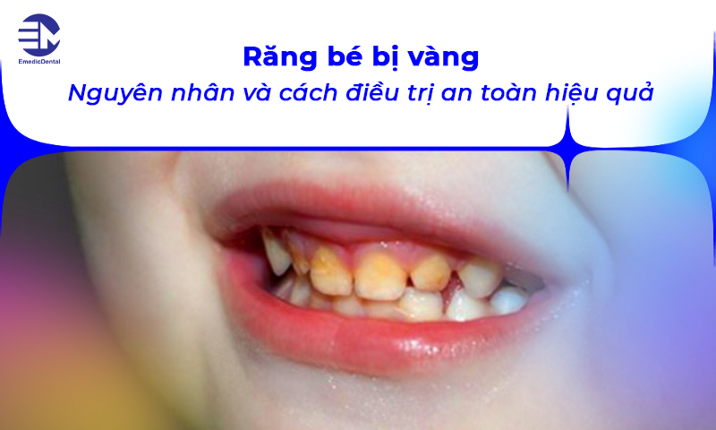 răng bé bị vàng