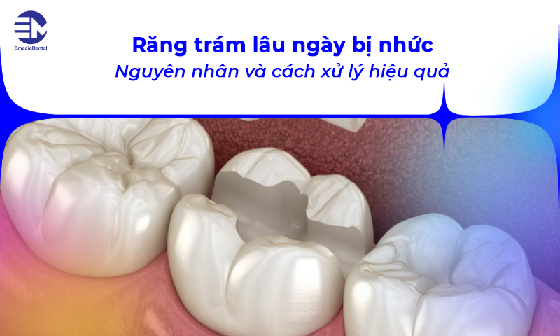 răng trám lâu ngày bị nhức