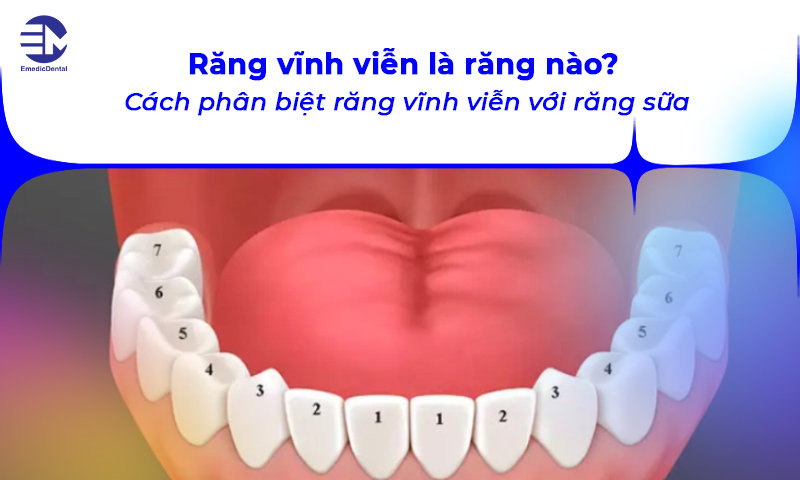 răng vĩnh viễn là răng nào