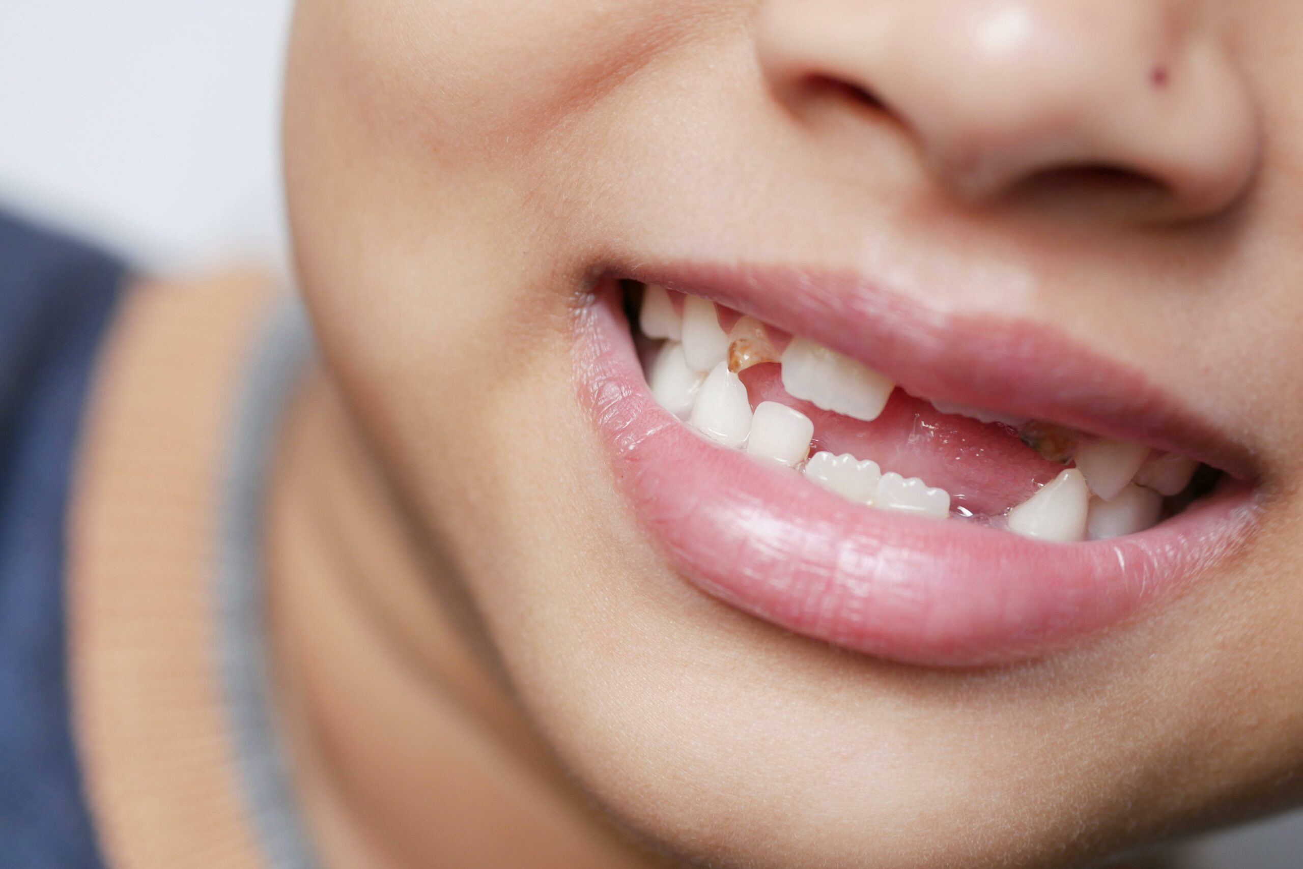 6 dấu hiệu cảnh báo sớm các bệnh lý răng miệng cần lưu ý