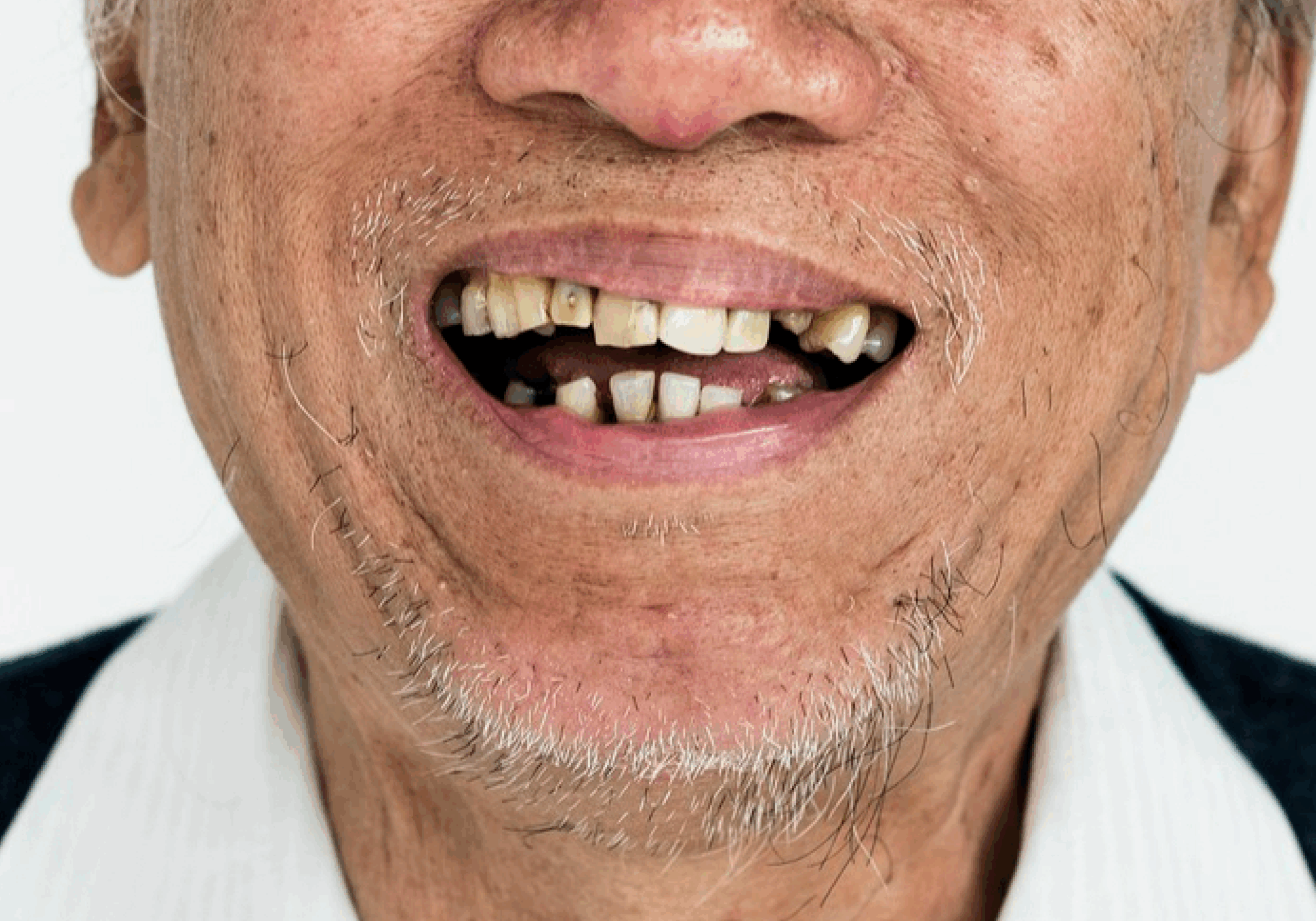 Vấn đề răng miệng ở người Việt